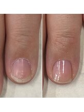 ネイルズ アヴァンティ(Nails Avanti)/最強のネイルケア3ヶ月コース
