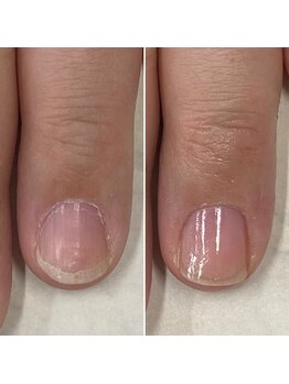 ネイルズ アヴァンティ(Nails Avanti)/最強のネイルケア3ヶ月コース