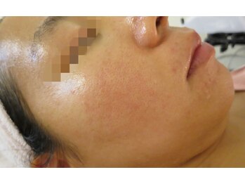 ビューティーメイクさくら/