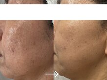 シェリー(cherie)/くすみ肌さようなら