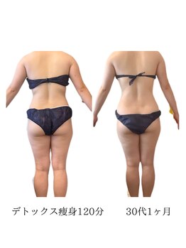 コーラル(Coral)/デトックス痩身(30代施術結果)