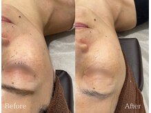 TD 鵜沼店/光フェイシャル