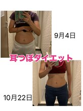 ゆいのわ/耳つぼダイエット