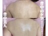 【人気NO.3】ダウンタイムなし背中のハーブピーリング\プレ花嫁様大人気/