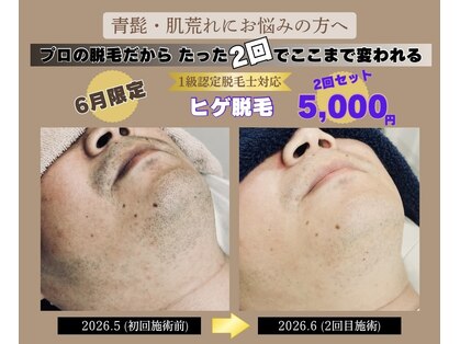 フォー(the 4)の写真