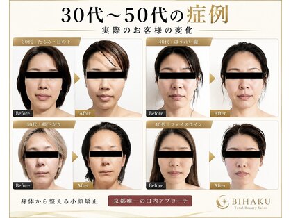 リコメンス(Recommence)の写真