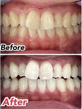 ホワイトニングスタイル 柏店/柏セルフホワイトニング