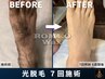 初回限定50%off メンズ ワックス脱毛×光脱毛 追加Sパーツ 2,000円→1,000円