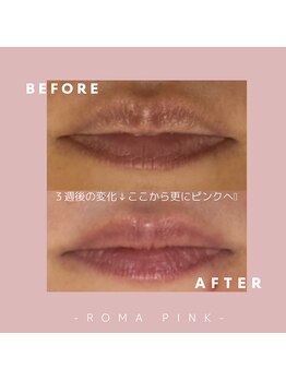 リスサロンドナース(LYS salon de Nurse)/ローマピンク