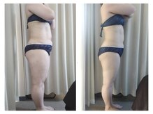 メリハリラボ(MeriHari.Lab)/【全身コース】ビフォーアフター