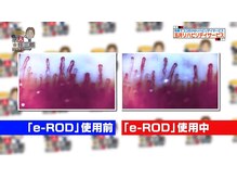 トータルケアハウス 五井/血管の流れを測定