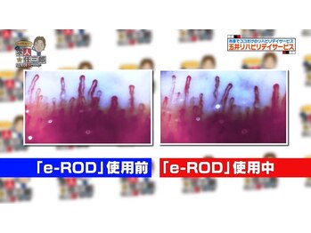 トータルケアハウス 五井/血管の流れを測定