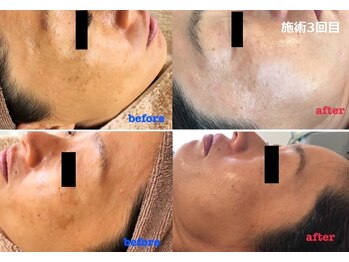 ナチュレアンドメディカ(Nature&Medica)/最新韓国美容の白玉フェイシャル