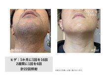 ディーエムピーコネクト(dmp connect)/