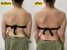 ユー(U)/産後ケアマッサージプラン