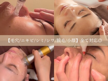 ウォーム(warm)の写真