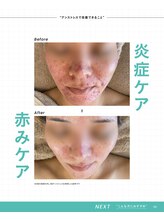 ユアンスボーテ(Yuence Beaute)