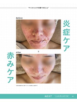 ユアンスボーテ(Yuence Beaute)の写真/クリスティーナの最高峰肌質改善アンストレスなど白玉水光肌になれるメニューがたくさん♪