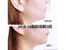 ココンフワット(Coconfouato)の雰囲気（即日脂肪撃退レモンボトル一度の施術でフェイスラインスッキリ◎）