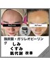【肌キメ・美白】韓国女優肌　最新 ガリレオピーリング　16500円→