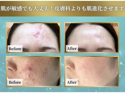 リメイククリニカルビューティー(Remake clinical beauty)の写真