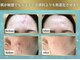 リメイククリニカルビューティー(Remake clinical beauty)の写真
