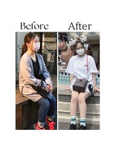 ラヴィニティ 池袋店(Lavinity)&nbsp;rino 