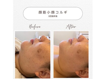エムボーテ 太田店(M BEAUTE33)の写真