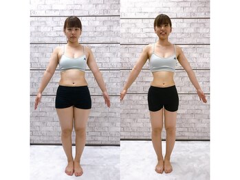 イーストレッチジム 大阪心斎橋店(E-STRETCH GYM)/ビフォーアフター