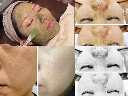 ペリドット(Peridot)の写真