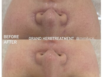 ミミルーチェ(mimiluce)/通常ハーブ2倍効果グランハーブ