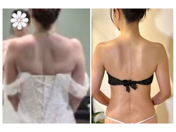 蒼(so)/「骨格」バランス矯正で大幅減量