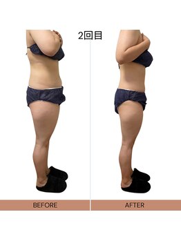 ママニエ(ma maniere)/全身痩身2回コース終了のお客様