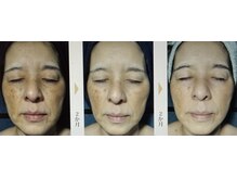 セラビシャン/before→after