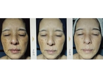 セラビシャン/before→after