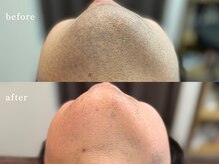 ボス 津店(BOSS)/【メンズ脱毛/ヒゲ脱毛】