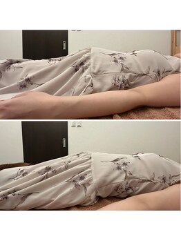 フォリオラ(Folivora)/妊婦整体施術前後のお写真