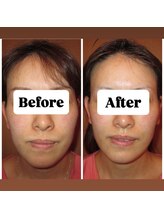 マンマ ジュンナ/【浜松/小顔/小顔矯正】