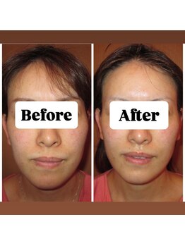 マンマ ジュンナ/【浜松/小顔/小顔矯正】