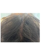 カブール 町田/頭皮環境を整える