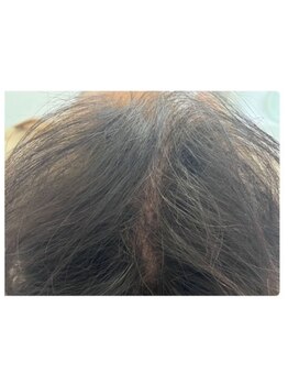 カブール 町田/頭皮環境を整える