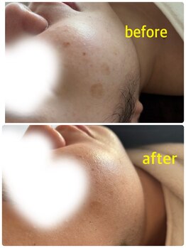 ココサロン(Coco Salon)/