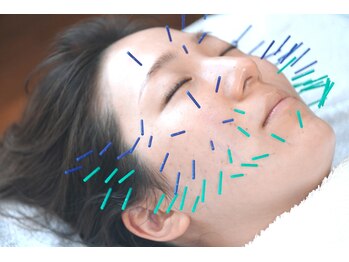 岩川治療院の写真/【エンビロン×美容鍼】☆相乗効果で、つるんとした透明感溢れる水光肌を実現。確かな技術で高い満足感を◎