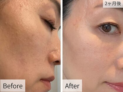 リッシュボーテ(RICHE BEAUTE)の写真