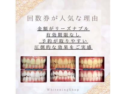 ホワイトニングショップ 武蔵小杉店の写真