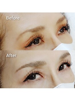 マツ(MATSU)/アングル＋×ハリウッドブロウ