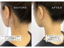 キラン(KIRAN)/えりあしワックス脱毛