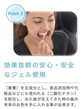 ホワイトニングショップ 新潟店/効果抜群安心安全なジェルを使用