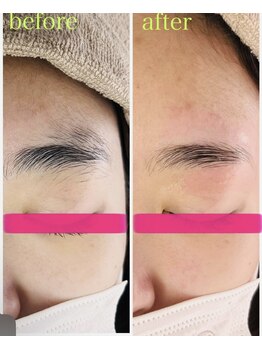 ハチイチゴ アイラッシュ(hachiichigo)/ブロウリフト