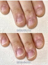 ポメロ(POMELO)/人差し指に注目わずか2週間でも